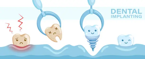 Affordable Dental Implants: Your Guide to Cost-Effective Solutions
